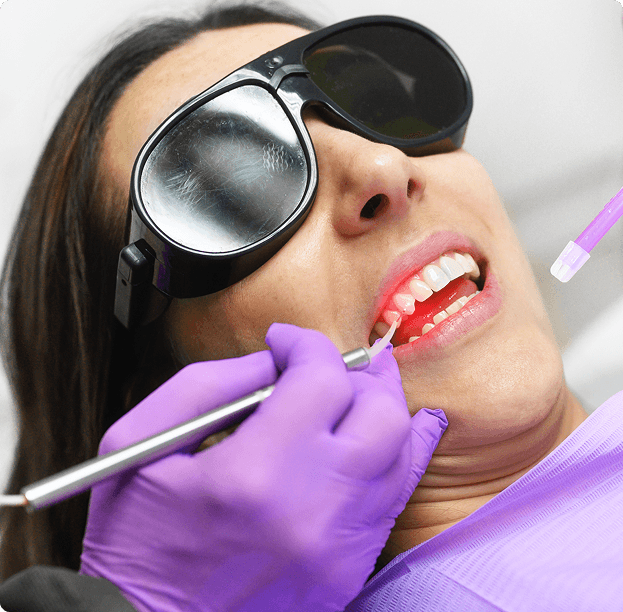 Laser Bacterial Reduction (LBR)